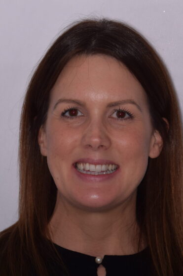 Smile Design Dental - Before